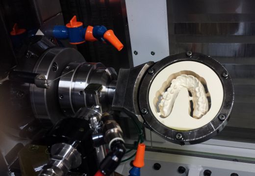 Machining the lower denture on a Willemin Macodel 408B